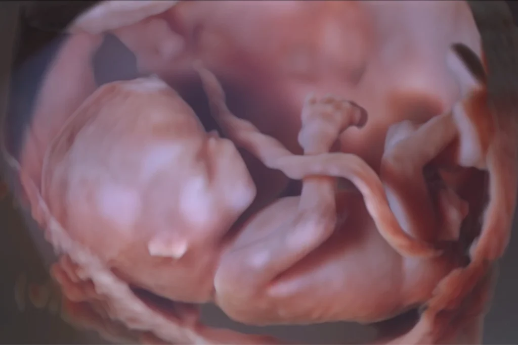 4D ultrahang vizsgálat Győr
